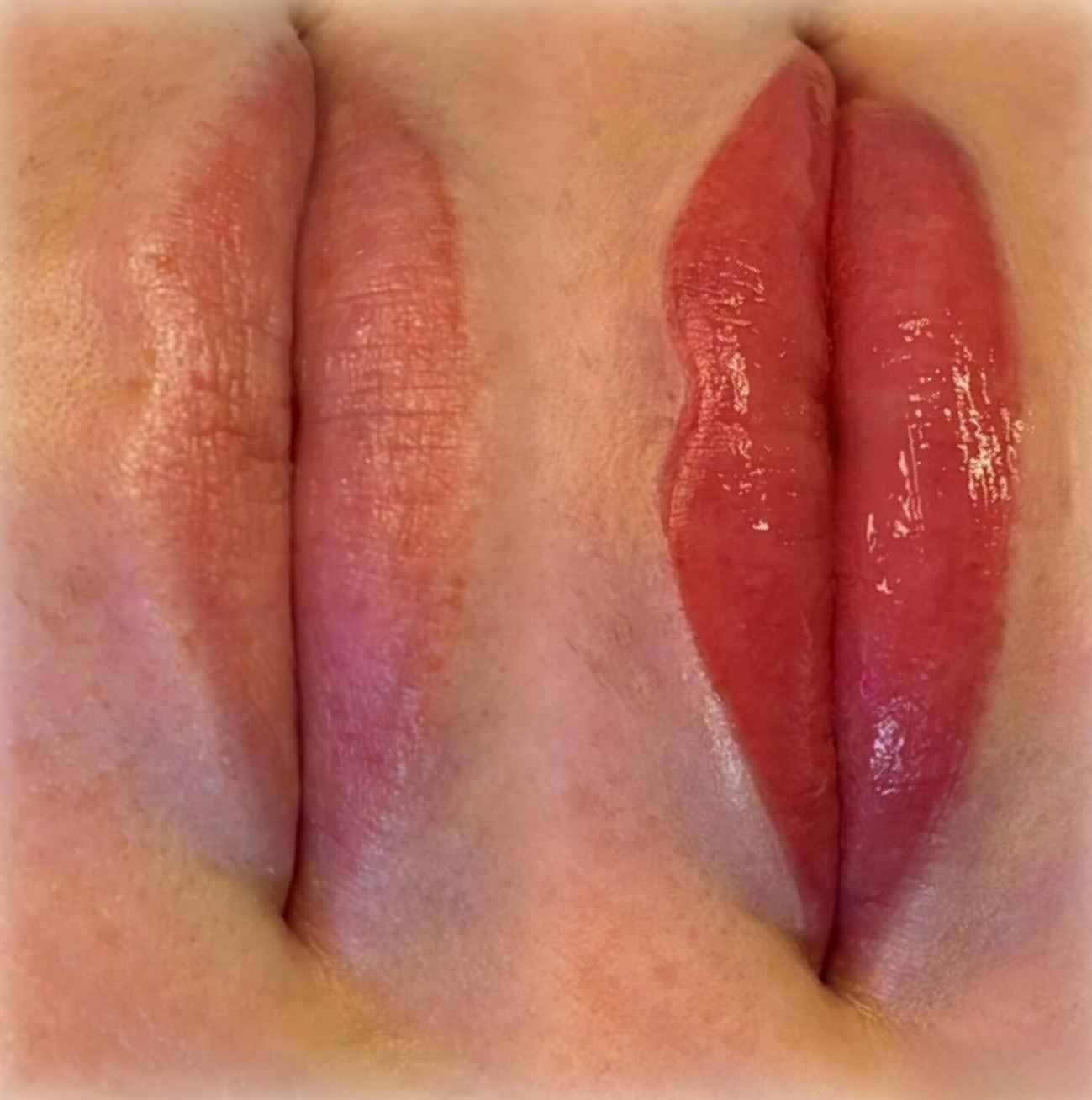 Healing, Prep and Touch-Up Tips