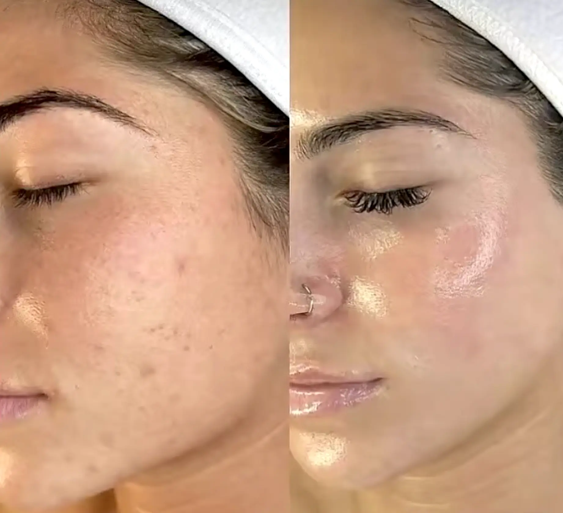 Prepping Your Skin