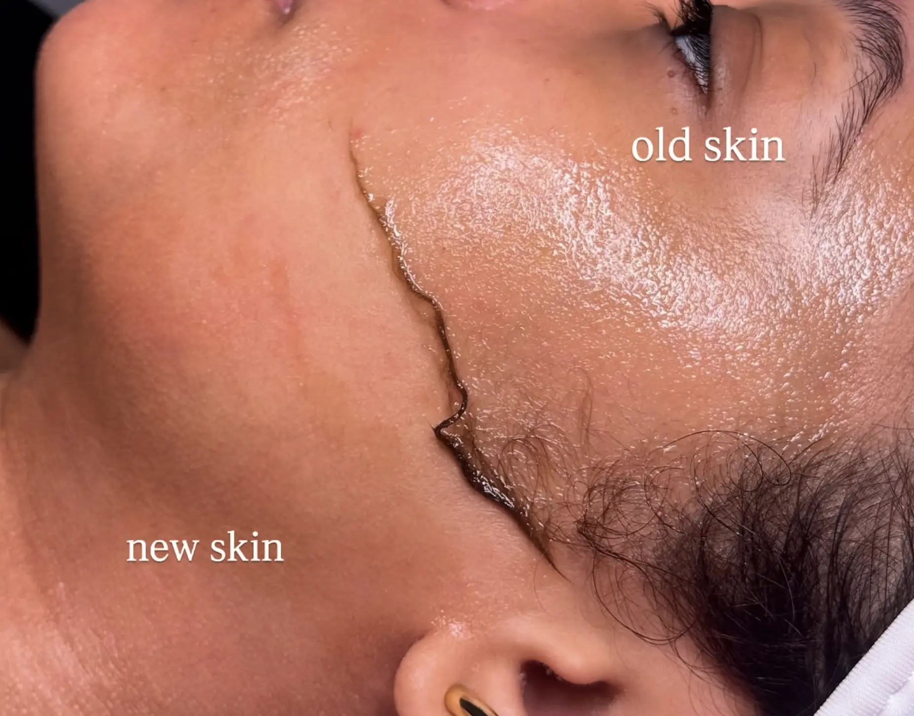 The Facial Hub