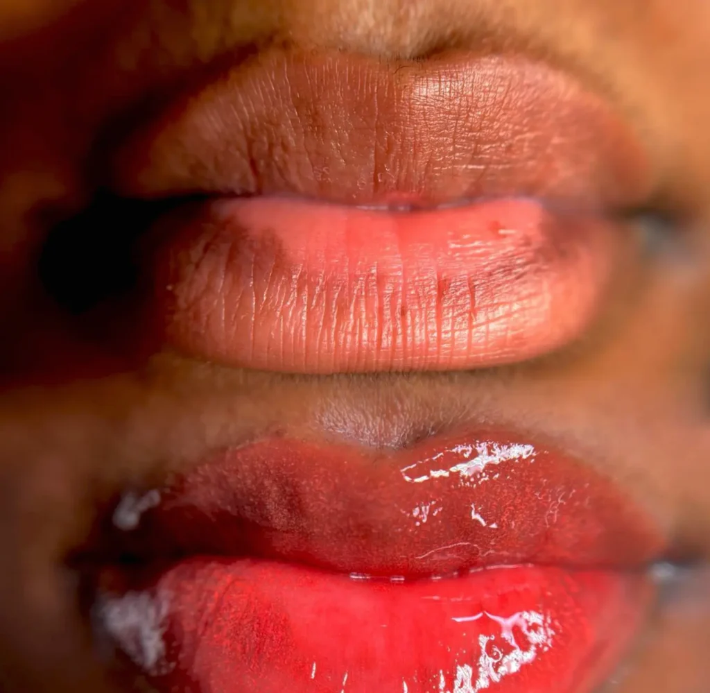When and How to Brush